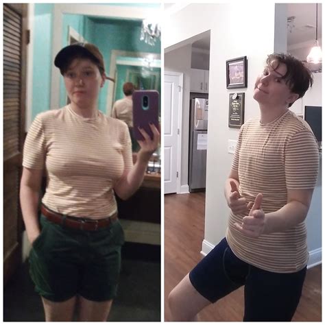 Pain Meds After Top Surgery at Brooke Plume blog