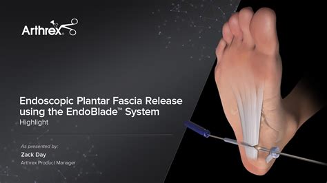 Plantar Fascia Surgery