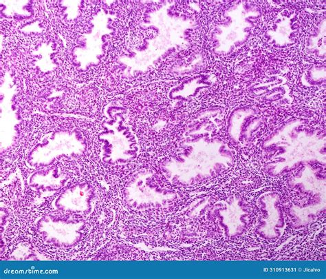 Endometrium. Secretory Phase Stock Image - Image of gland, uterus: 310913631