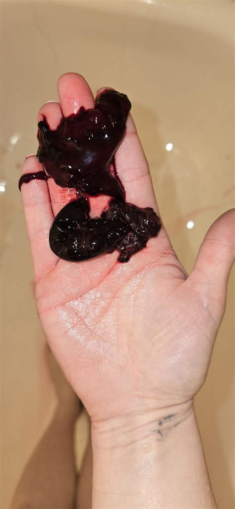 Uterine Lining Shedding Tissues Scientists Grow Womb Lining Models