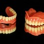 Image result for prosthodontics