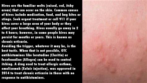 Image result for Different Types of Skin Conditions