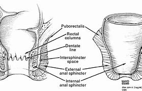 Image result for perianal