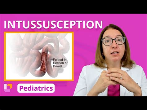 Image result for Definition of Intussusception