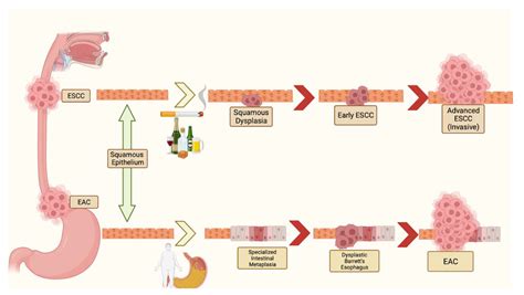 Advancing Esophageal Cancer Treatment: Immunotherapy in Neoadjuvant and Adjuvant Settings