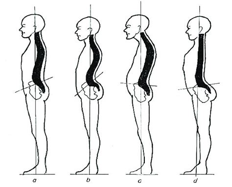 Different Types of Posture 的图像结果