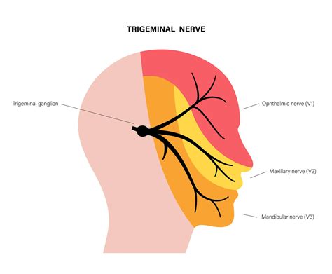 Trigeminal Neuralgia: Causes, Symptoms, And Treatments