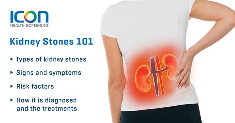 What causes kidney stones? — Icon Health Screening