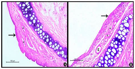 Lipid Nanocarriers Overlaid with Chitosan for Brain Delivery of ...