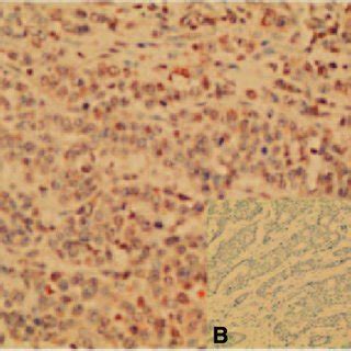 Negative Magnification 的图像结果