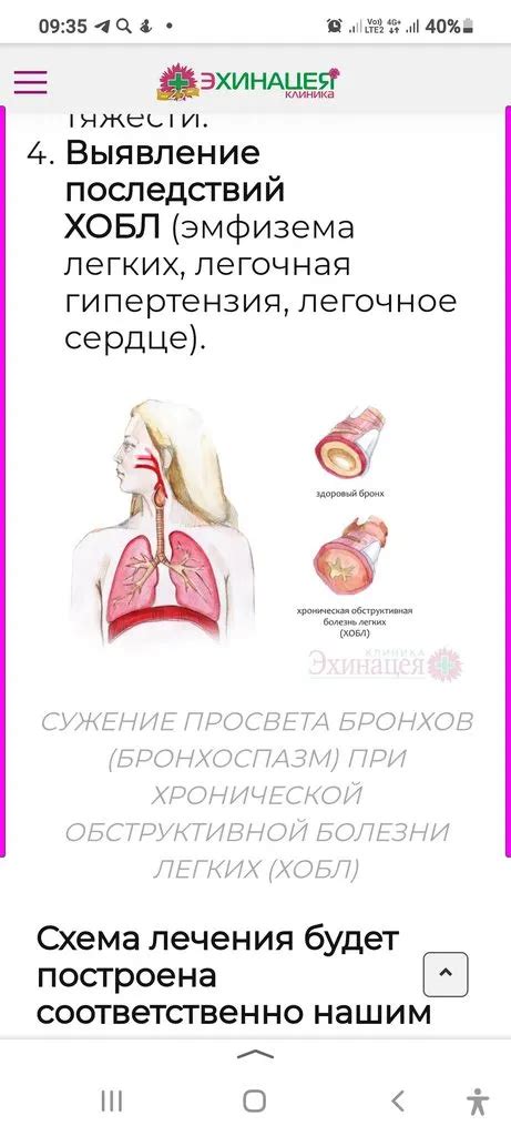 Я и моя астма. Мини-форум для астматиков и сочувствующих - Страница 11 ...