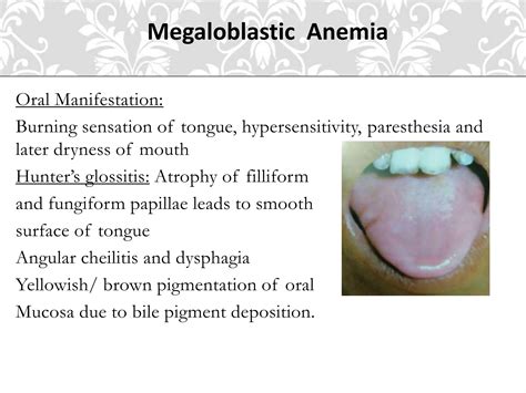 Oral manifestation of bleeding disorders | PPTX
