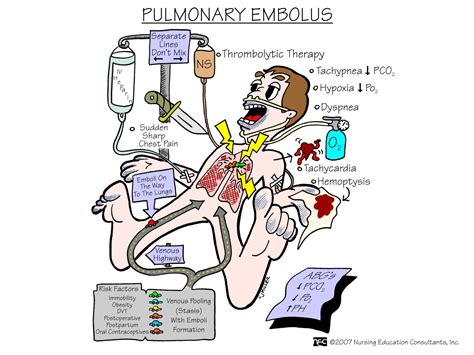 Nursing Mnemonics and Tips | Nursing mnemonics, Medical surgical nursing, Nursing school survival