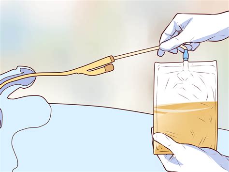 Cómo insertar un catéter: 11 Pasos (con imágenes)