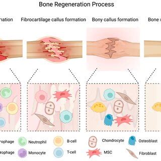 Image result for Bone Healing Process