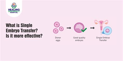 What is Single Embryo Transfer? Is it more effective? - Healing Hospital