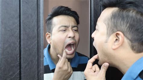 Black Tartar on Teeth: Causes, Prevention & Removal