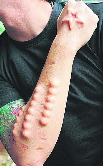 Body Modification Using Tying 的图像结果