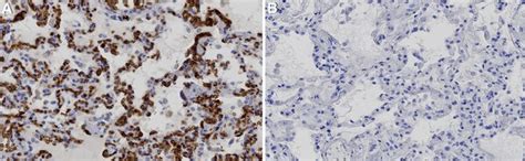 Anti-GLUT-1 Antibody, CT | 07-1401
