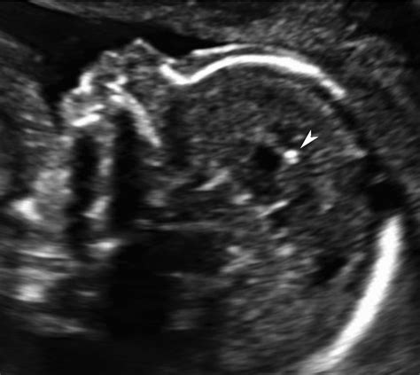 Intrauterine and Perinatal Infections - Clinics in Perinatology