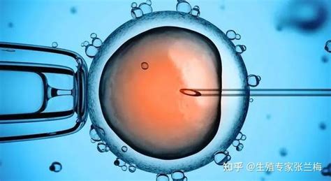 试管婴儿B超卵泡监测：了解卵泡生长，预测排卵时间 - 每日头条