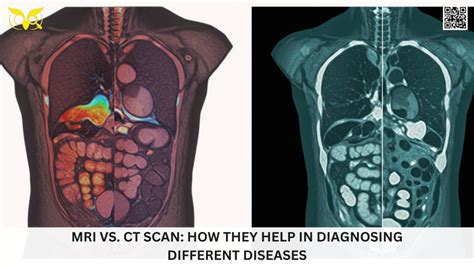Image result for MRI Vs CT Scan