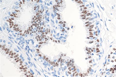 Progesterone Receptor antibody (66300-1-Ig) | Proteintech