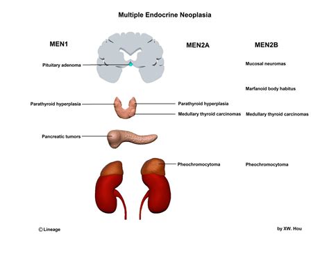 Multiple Endocrine Neoplasias | Genetic Tumor Syndromes