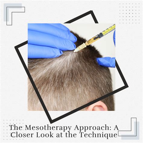 Mesotherapy Versus PRP - The Ultimate Guide for Tackling Hair Loss ...