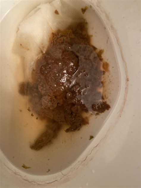 Exploding Poop Human 的图像结果