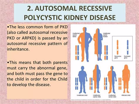 Polycystic kidney disease | PDF