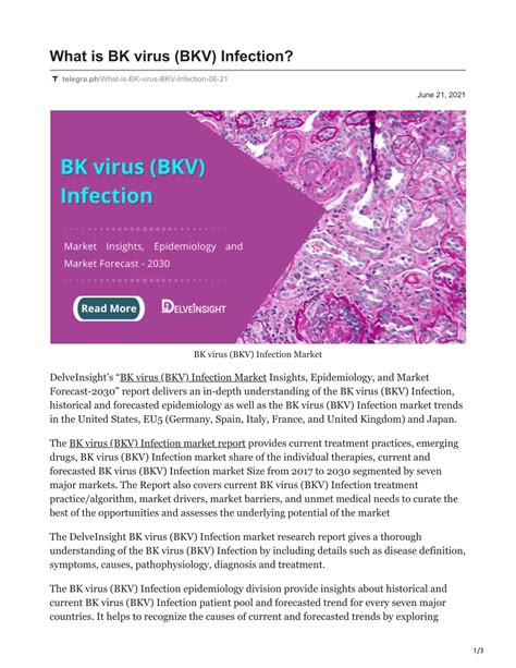 PPT - What is BK virus BKV Infection PowerPoint Presentation, free ...