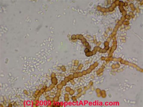 Mold Under Microscope 的图像结果
