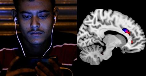 Shocking Scans Show How Constantly Using Phones Damages Our Brain Just ...