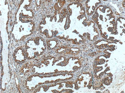 MUC16/CA125 antibody (60261-1-Ig) | Proteintech
