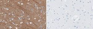 Anti-Presenilin-1 Antibody, clone 2O13 ZooMAb® Rabbit Monoclonal ...