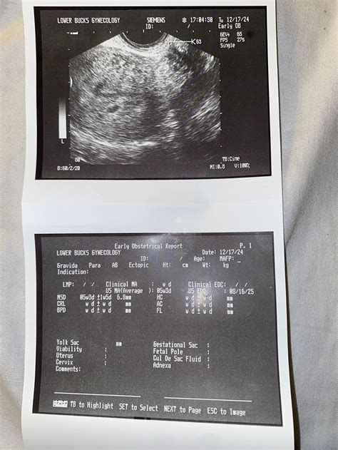 No visible yolk sac or fetal pole | BabyCenter