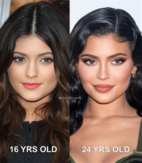 Kylie jenner plastic surgery before and after images the teal mango – Artofit
