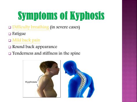 PPT - Kyphosis: Curved Thoracic Spine PowerPoint Presentation, free download - ID:7477426