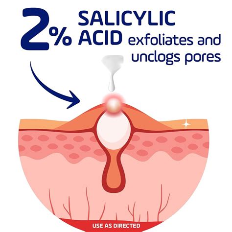Asepxia 2% Salicylic Acid Acne Spot Treatment Cream India | Ubuy