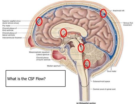 Image result for CSF Flow Test