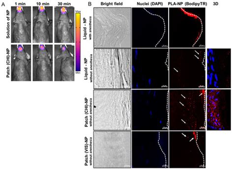 Mucosal Adjuvants Delivered by a Mucoadhesive Patch for Sublingual ...