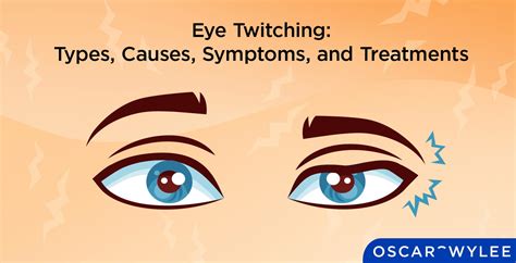 Eye Twitching: Types, Causes, Symptoms, and Treatments