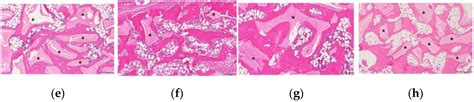 Long-Term Changes in Adipose Tissue in the Newly Formed Bone Induced by ...