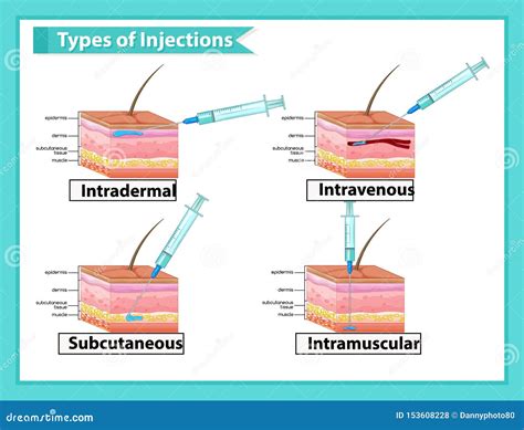 Image result for Subcutaneous Injection Procedure