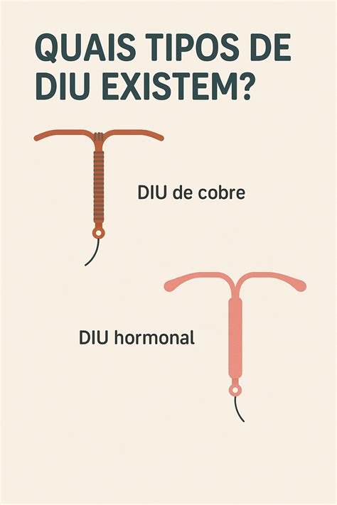 O que é diu e como funciona?