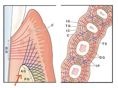 Image result for Two Walled Defect Perio