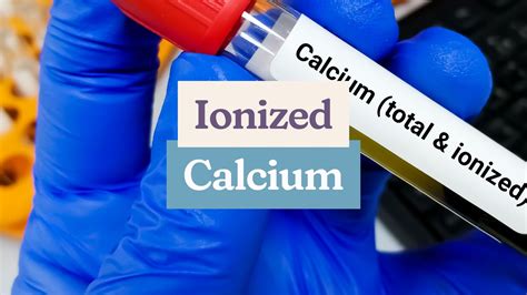 Ionized Calcium Test