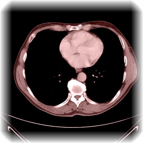 Dicom Medical Image Viewer - App on Amazon Appstore