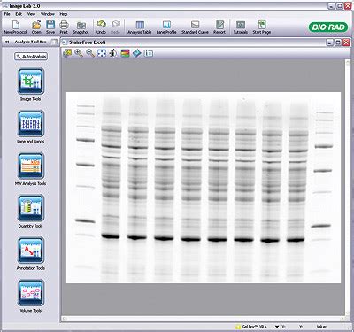 Image result for Bio-Rad Image Lab Densitometry